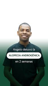 Angelo se sentía devastado 😢...