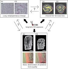 Besides good quality brands, you'll also find plenty of discounts when you shop for bone model during big sales. Plos One Effects Of Long Term Cigarette Smoke Exposure On Bone Metabolism Structure And Quality In A Mouse Model Of Emphysema