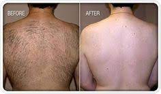 Permanent hair removal at home? 8 How To Shave Your Own Back Ideas Back Shaver Shaving Body Shaver