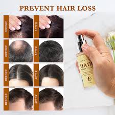 Combat dandruff/itchy scalp while nourishing and. Buy Venanoci Hair Growth Oil Effective For Hair Growth Hair Loss Liquid Hair Growth Formula Hair Care Serum For Thicker Healthier Hair Reduces Hair Shedding Thinning Online In Hong