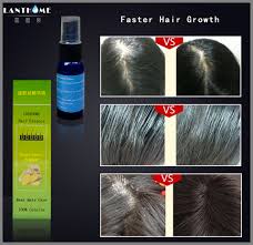 Searching for the best hair growth products that actually work? 1pc Fast Hair Growth Product Wham Deals