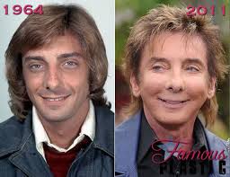 Celebrity Plastic Surgery Before After 56 Pics Celebrity Plastic Surgery Plastic Surgery Plastic Surgery Fail