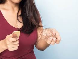 Pcos Hair Loss Cause Treatment Home Remedies And Support