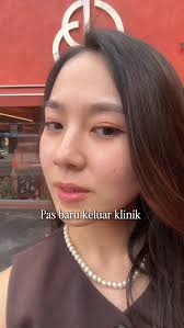 Angel Karamoy Glow-Up di Korea! 🇰🇷✨ Angel Karamoy menjalani transformasi  wajah di Korea bareng @myvenus.io! 💖 Dari konsultasi sampai operasi,  semuanya didampingi biar hasilnya maksimal! 😍 ✨ Prosedur yang dilakukan:  💎 Face