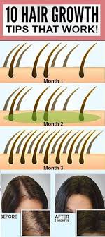 Black Hair Biotin Hair Growth Before And After Pictures Hair Fall Has Become A Growing Problem For Most People These Days Both In Men Or Women The Problem Is The Thicker Stronger Hair Strong Hair Hair Growth Tips