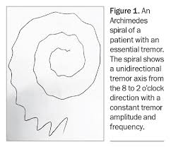 Image result for Tremor
