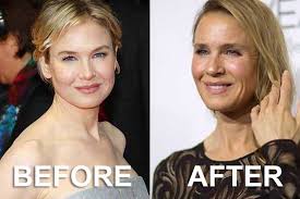 Renee zellweger pens response to plastic surgery rumors: Thoughts On Branding Via Renee Zellweger Lenz Marketing
