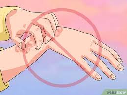 Remove your clothing and hose off your arms and hands immediately after working with fiberglass to avoid irritation in the future. How To Lessen Fiberglass Itch 12 Steps With Pictures Wikihow