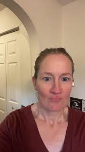 #implants #journey #longtime #final #pmma #zirconia