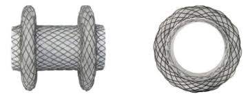 Insert axios™ system & tighten luer lock •. Lumen Apposing Metal Stents For Benign Gastrointestinal Tract Strictures An International Multicenter Experience