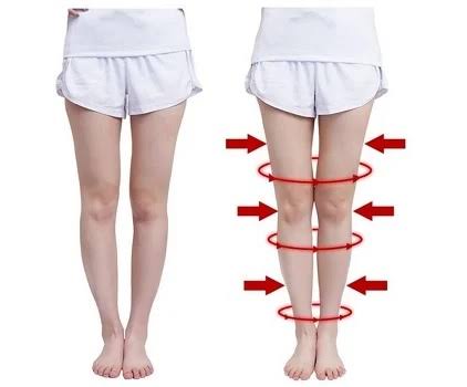 Các bài tập chữa chân vòng kiềng ở người lớn