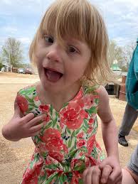 Living with focal seizures and epilepsy