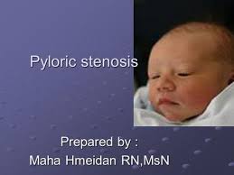 OB Unit 4 Chpt. 27 Care of the Newborn Rev ppt download