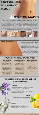 3 Essential Oils To Naturally Reduce Stretch Marks Organic Aromas