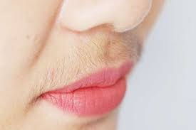 Androgens are male hormones, including testosterone and dhea. 3 Amazing Ways To Remove Facial Hair