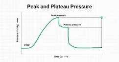 What is Plateau Pressure? An Overview (2024)