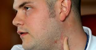 Wounded St. Louis officer hopes his recovery gets him back