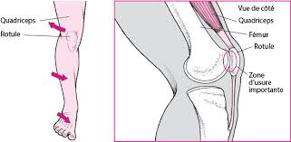 Vous vous demandez dans quelles conditions recourir ? Douleur Dans La Partie Avant Du Genou Lesions Et Intoxications Manuels Msd Pour Le Grand Public