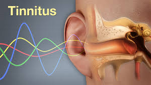 Image result for Tinnitus