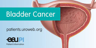 Each year in the united states, about 56,000 men and 17,500 women get bladder cancer, and about 12,000 men and 4,700 women die from the disease. Bladder Cancer Patient Information