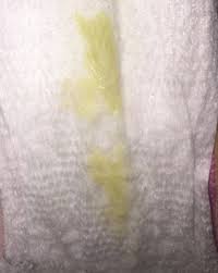 Flujo Amarillo Con Sangre En El Embarazo Flujo Dorado Durante El Embarazo Causas Consecuencias Sintomas Y Casos