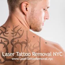 Laser tattoo removal can be a lengthy and time consuming process. Laser Tattoo Removal Dermatology Request An Appointment 15 Photos Tattoo Removal 21 East 87th St Upper East Side New York Ny Phone Number Yelp