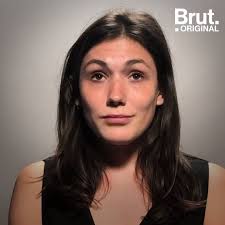 La mucoviscidose est une affection familiale fréquente avec environ une naissance sur 2 000 touchée. Interview Brut Lea Moret 23 Ans Atteinte De La Mucoviscidose Brut