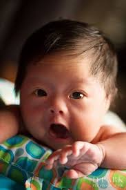 Para los niños con síndrome de down con mosaicismo, algunas de las células tienen 3 copias del cromosoma 21, pero. 32 Sindrome De Down Ideas Down Syndrome Down Syndrome Kids Down Syndrome Baby