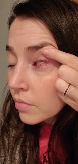 I am switching over from Synthroid to NP thyroid. I was diagnosed with  Graves' disease about 15 years ago and Hashimoto's. Between synthriod and  np thyroid I was using a natural bovine