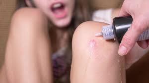 There have been some cases where bleach has actually lightened the skin, jarosz warns, although the result is usually temporary. Does Hydrogen Peroxide Cure These Ailments Snopes Com