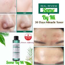 Biossance Squalane Tea Tree Balancing Oil Review Pin Oleh Annara Beauties Di Annara Kbeauty