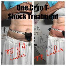 Pin On Cryo T Shock