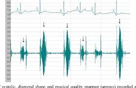 The important piece to remember is that a heart murmur is not a concerning condition on its own. Pdf Musical Murmur In A Dog With Acute Chordae Tendineae Rupture Semantic Scholar