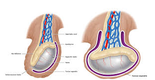 Image result for Cremasteric Reflex