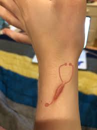 Get rid of your ugly keloids!!! This Is My Least Favorite Keloid I M A Nursing Student And I M Thinking About A Small Tattoo To Make This Guy A Bit More Meaningful Any Opinions Selfharmscars