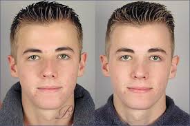 Male Rhinoplasty: George's Nose Job Experience & Unexpected Benefits  (Updated 2024)