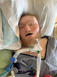 Dilated eyes appearance