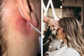 Unlike permanent hair dyes, temporary dyes do not stay on your skin for long. Coronavirus Hairdressers Warned Over Post Covid Dye Allergy Risk Heraldscotland