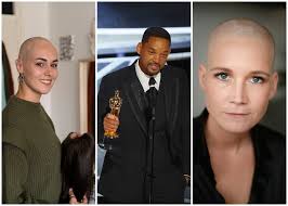 Twentse vrouwen met haarziekte snappen woedende Will Smith: 'Dit is onze  grootste nachtmerrie'