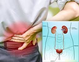 In men, the development of a varicocele, or a clump of enlarged veins, may appear around a testicle. Best Laparoscopic Nephrectomy Cost India Kidney Cancer Surgery Hospitals India