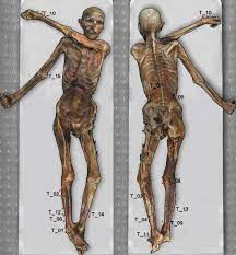 By using ct scans of his throat and the tissue around his voice box, the researchers believe there is a chance to recreate the sounds of his voice with. Ancient Ink Iceman Otzi Has The World S Oldest Tattoos Smithsonian Institution