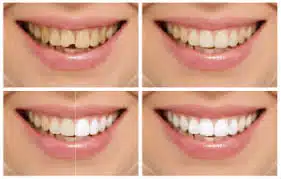Cosmetic Services