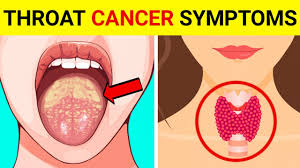 That's a cancer of the lymph system and bladder cancer. Throat Cancer Signs And Symptoms Of Throat Cancer Throat Cancer Symptoms Youtube