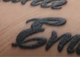 By this type of tattoos, they give a realistic look to tattoos. Das 3d Tattoo Fallbeispiel Von Haut Veranderungen An Tatowierungen Bei Sarkoidose Fachportal Fur Wehrmedizin Wehrpharmazie