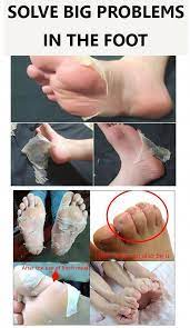 Foot Peeling Masks Peeling Mask Skin Foot Mask
