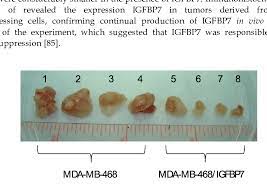 Mammogram examples and ultrasound breast pictures. Effect Of Igfbp7 Overexpression On Breast Tumor Formation In Vivo 5x10 Download Scientific Diagram
