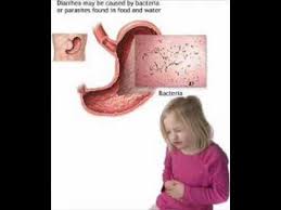 Its meaning is 'दस्त' which can be transliterated into english as 'dast'. Diarrhea In Children Health Education Infection Control Icsp Urdu Hindi Part 1 Of 2 Youtube