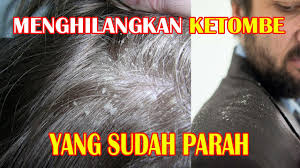 Namun pada air liur, kandungan dap hilang dalam waktu 2jam sampai 1 minggu setelah pemakaian. Cara Menghilangkan Khayal Syabu Kesan Syabu Pada Kesihatan