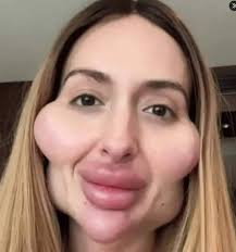 Anastasia Pokreshchuk, a Ukrainian...