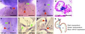 Camera de hotel 309 ep. Haemodynamically Dependent Valvulogenesis Of Zebrafish Heart Is Mediated By Flow Dependent Expression Of Mir 21 Nature Communications